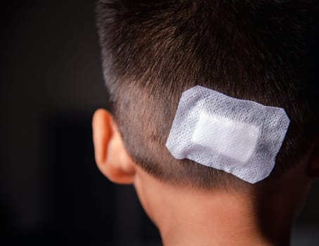 The lacerated suture wound of kid back head which suture with trauma the head by medical bandage, Medical care of the surgery lesion on the head, children of Accident