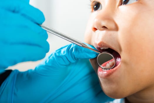 Dental kid health examination. Asian dentist making examination procedure for cute little girl open mouth, Doctor examines oral cavity of little child uses mouth mirror to checking teeth cavity