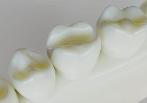 removed amalgam filling from a tooth -- 3D Rendering