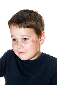 sad boy with a scraped face