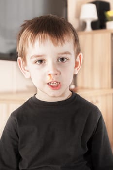 ill boy with flu and green rhinitis at nose