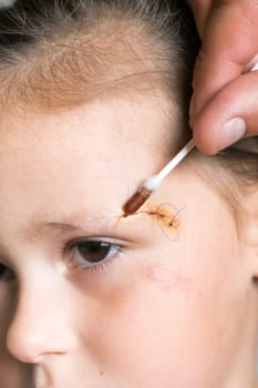 Vertical close up patient, tired child girl face with cropped man hand healing, apply Iodine on cotton swab to stitches on scratch. Clean scar, wounds. Children physical injuries and family abuse