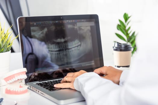 Dentist doctor or nurse in uniform use oral software teeth Xray and typing information medical history form into laptop computer for record document report, tooth model on desk, dentistry concept