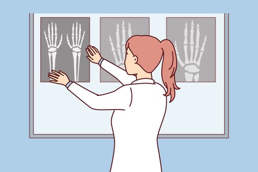 Woman surgeon applies X-ray of hand to luminous board to see sites of bone fracture in patient. Girl nurse stands with back to screen looking at images made after fracture. Flat vector design