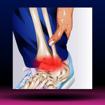 Anterior Longitudinal Ligament - Body Parts - Spine - Skeleton - Medical - Graphic - Joint