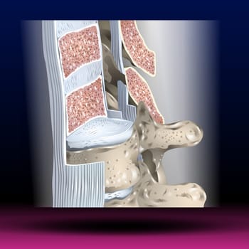 Anterior Longitudinal Ligament - Body Parts - Spine The anterior longitudinal ligament is a ligament that runs down the anterior surface of the spine.
