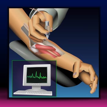 The illustrate explain Use of medical electrical tools to checking for neuromuscular disease, By using stimulation from electrical signals.