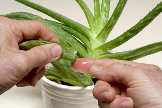 Aloe Vera used for burns.