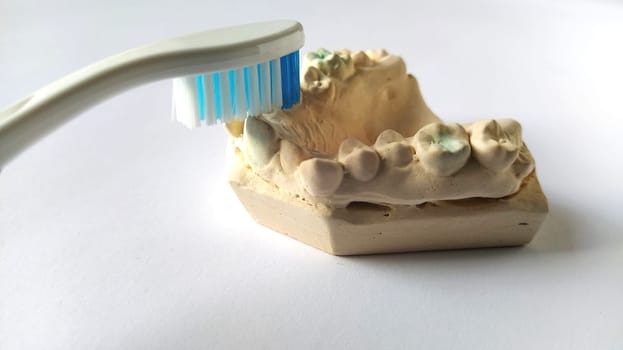 Toothbrush and mock human jaw. Plaster lower jaw. Dental and health care concept. White background. Bright yellow and blue color. Rugged, crooked teeth. Help of the dentist and orthodontist.