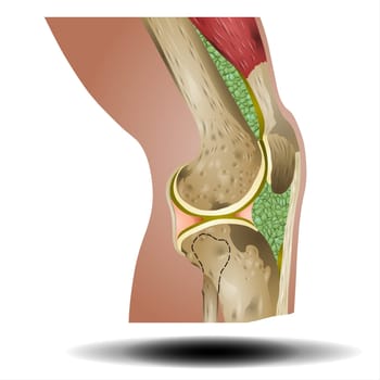 Bones Pain, Injury and Inflammation, Knee Joint Pain Silhouette Icon Ache of Knee, Leg Skeleton, Arthritis, Osteoporosis and Bones Joint, Illustration