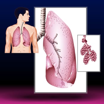 Model human body - lungs - Vector Illustration