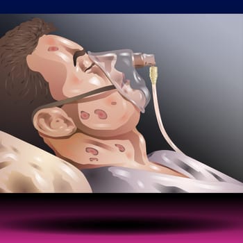 Male Patient in Hospital Having Artificial Lung Ventilation Being in Critical Condition Lying on Bed with Mask Vector