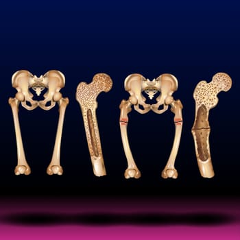 Structure of the pelvis. Anatomical poster of human skeleton. Pelvic bones concept. Sacrum, Ischium, pubis and ilium. Medical vector illustration.