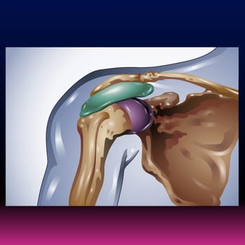 The shoulder is one of the largest and most complex joints in the body. The shoulder joint is formed where the humerus (upper arm bone) fits into the scapula (shoulder blade), like a ball and socket. Vector Illustration