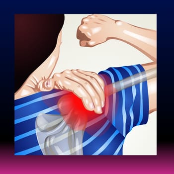 Most shoulder problems fall into four major categories: Tendon inflammation (bursitis or tendinitis) or tendon tear  Instability  Arthritis.