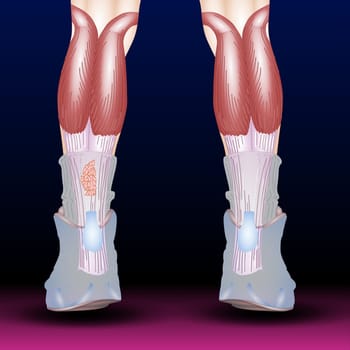 Tendinitis is inflammation or irritation of a tendon — the thick fibrous cords that attach muscle to bone. The condition causes pain and tenderness just outside a joint. While tendinitis can occur in any of your tendons, it's most common around your shoulders, elbows, wrists, knees and heels.