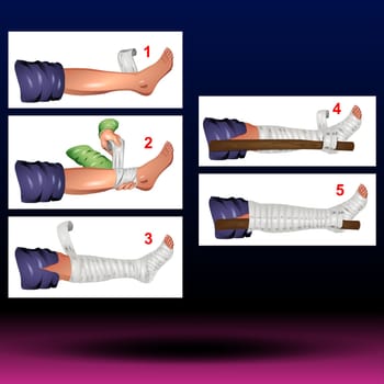 Pain in leg, arm, shoulder or head. Bandage, medical gauze wrapping and treatment. Broken or injured bones. First help in the clinic. Sprained ligaments concept. Limbs trauma vector flat illustration.