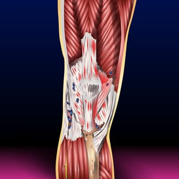 Tendinitis is inflammation or irritation of a tendon — the thick fibrous cords that attach muscle to bone. The condition causes pain and tenderness just outside a joint. While tendinitis can occur in any of your tendons, it's most common around your shoulders, elbows, wrists, knees and heels.