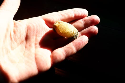 Gallstone disease, cholelithiasis - the formation of stones, stones in the gallbladder, bile ducts. Gallstones. A large gallstone removed from a patient's body, 2.5 cm long