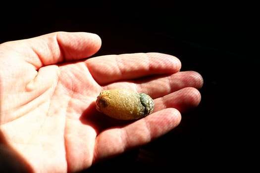 Gallstone disease, cholelithiasis - the formation of stones, stones in the gallbladder, bile ducts. Gallstones. A large gallstone removed from a patient's body, 2.5 cm long