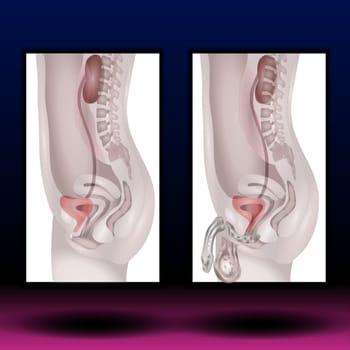 Male and female urogenital system. Vector illustration. Human anatomy.