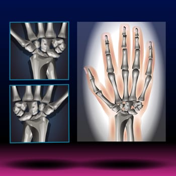 Carpal bones. Human hand anatomy. small bones of the wrist: Scaphoid, Lunate, Triquetrum, Pisiform, Trapezium, Trapezoid, Capitate and Hamate. Vector illustration