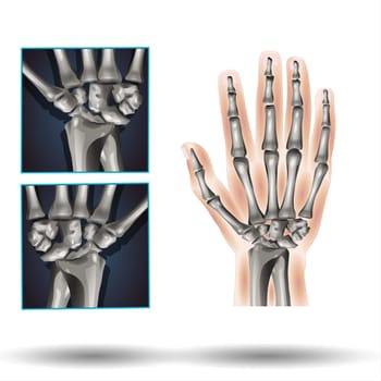Carpal bones. Human hand anatomy. small bones of the wrist: Scaphoid, Lunate, Triquetrum, Pisiform, Trapezium, Trapezoid, Capitate and Hamate. Vector illustration