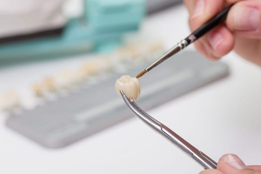 In a dental laboratory,a dental crown is colour-adjusted.
