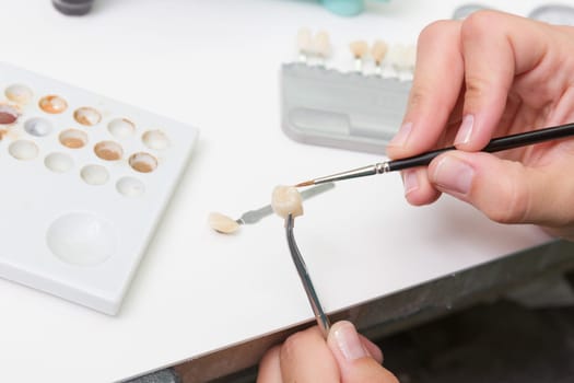 In a dental laboratory,a dental crown is colour-adjusted.