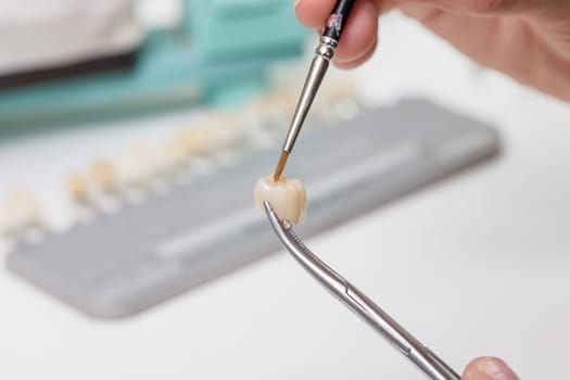 In a dental laboratory,a dental crown is colour-adjusted.