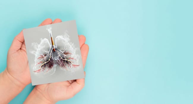 Lung with smoke, x-ray of the organ, world no tabacco day, unhealthy addiction , medical health risk, lung made with generative AI