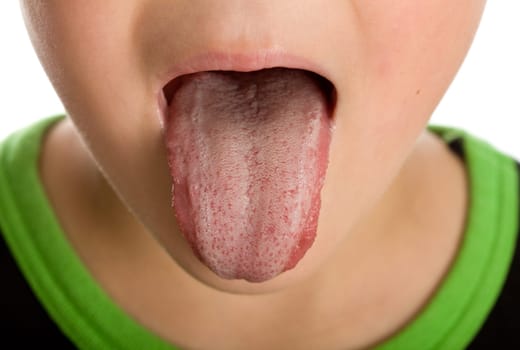Kid sticking out unhealthy furred or coated tongue - closeup