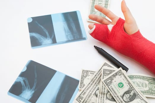 Medicine stillife with copyspace. Hand is bandaged in red plaster and splint in oreder to support the healing process.