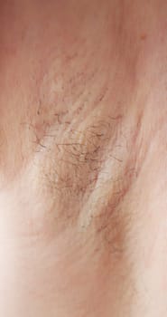 Young Woman With Hairy Armpit. Hair Removal And Shaving