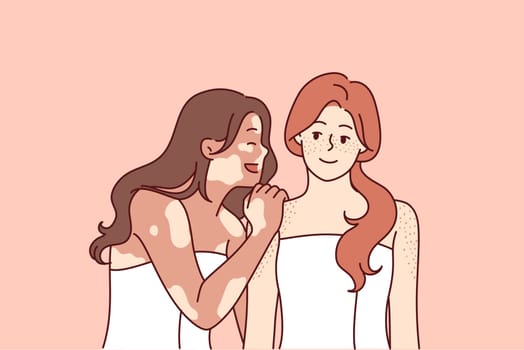 Woman with vitiligo syndrome hugs friend in bath towel and laughs enjoying fellowship and tolerance. Two cheerful girlfriends with freckles on skin or spots associated with vitiligo pigmentation