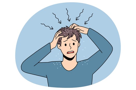 Itchy head and dandruff concept. Stressed irritated man standing and having itchy scalp feeling problems with health and scratching hair vector illustration