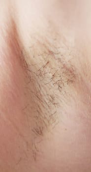 Young Woman With Hairy Armpit. Hair Removal And Shaving