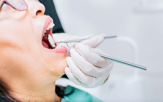 Dentist checking patient's mouth, Close up of patient checked by dentist, close up of dentist's hands checking patient's mouth, Dentist performing stomatology