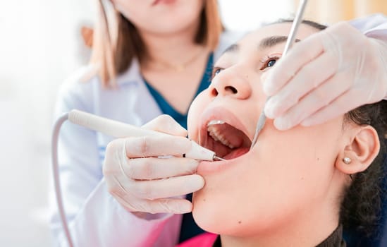 Patient checked by dentist, Dentist doing dental checkup, Close up of dentist checking patient with excavator and dental mirror, Dentist checking patient with excavator and dental mirror