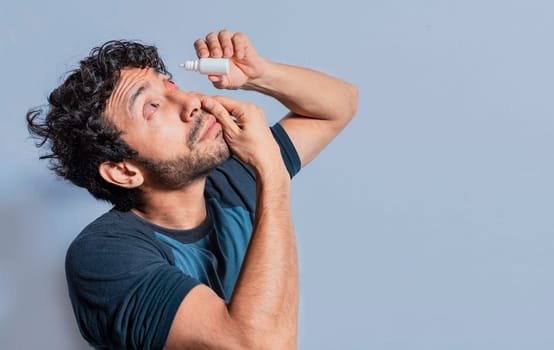 Person applying dropper to irritated eye. People applying refreshing drops to irritated eye. Man putting a dropper in his eye isolated. Man with irritated eye applying drops with a dropper