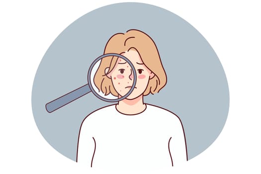 Unhappy woman with acne on face under magnifying glass. Upset young female suffer from skincare problems. Dermatology and cosmetology. Vector illustration.
