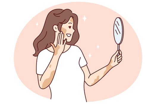 Smiling woman with vitiligo look in mirror feeling body positive. Happy girl with skin disease feel satisfied and optimistic. Skincare and dermatology. Vector illustration.