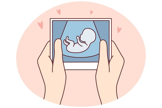 Hands of person holding scan of embryo waiting for baby birth. Future mother with ultrasound picture of baby. Motherhood concept. Vector illustration.