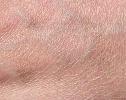 White person skin texture, close up