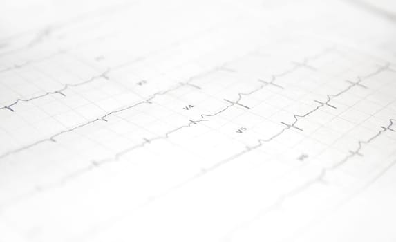 a card with a cardiogram of the heart. High quality photo