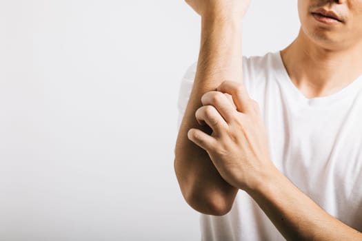 Portrait of unhappy man scratching his arm, dealing with itchiness, potentially from mosquito bite. Studio shot isolated on white, emphasizing skin-related health problems like dermatitis and scabies.