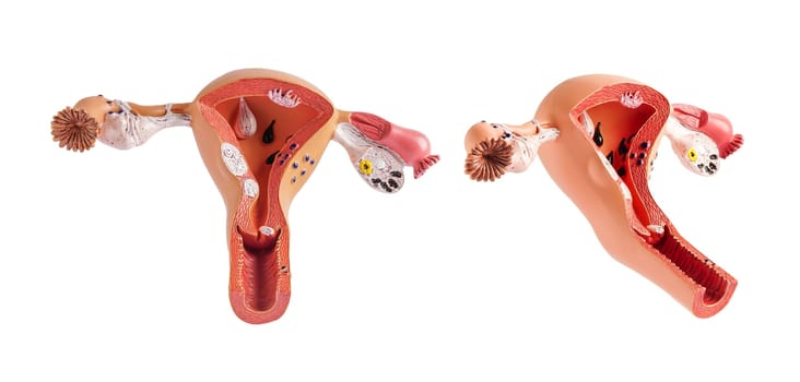 Uterus model isolated on white background with clipping path, doctor holding anatomy model for study diagnosis and treatment in hospital.