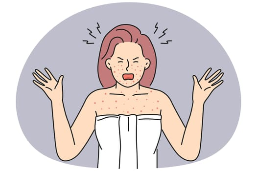 Angry woman in towel shout distressed with red body inflammation. Furious female anxious with allergy reaction or dermatitis. Vector illustration.