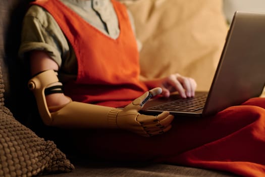 Myoelectric hand of schoolgirl with disability holding laptop on knees while sitting in front of camera and having online lesson