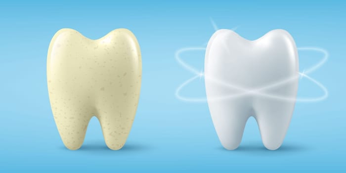Vector Banner with Realistic Dirty and Clean Tooth. Cleaning Concept, Before, After Hygienic Teeth Cleaning. Dentistry Design for Medical, Toothpaste Advertisement. Healthy Oral Hygiene, Teeth Care.